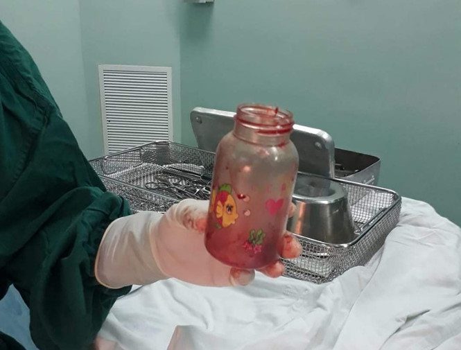 Người đàn ông nhét bình sữa vào... hậu môn để trị thoái hóa cột sống Người đàn ông nhét bình sữa vào... hậu môn để trị thoái hóa cột sống