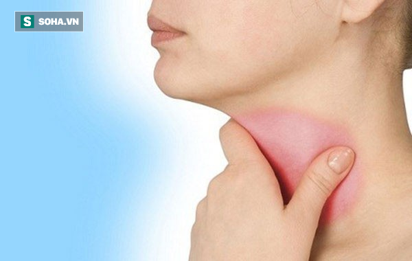 Ung thư tuyến giáp là bệnh khó phát hiện: BS khuyến cáo những người có nguy cơ cao mắc