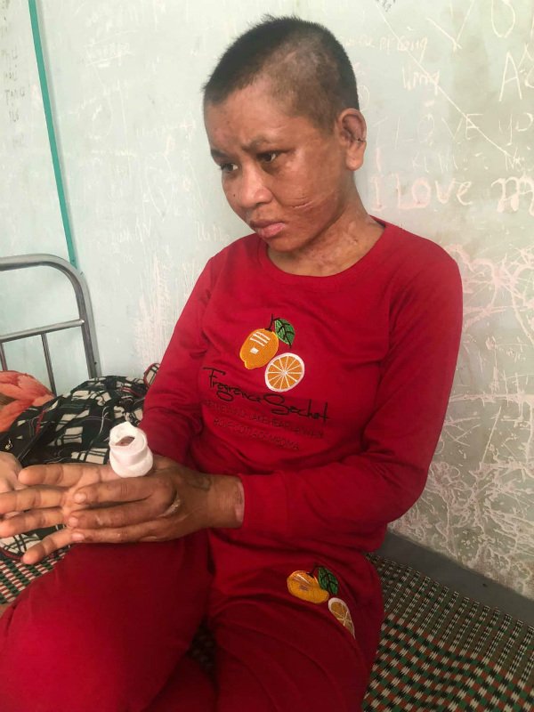 Truy tìm 5 nghi can cùng chủ nhà bạo hành dã man người giúp việc