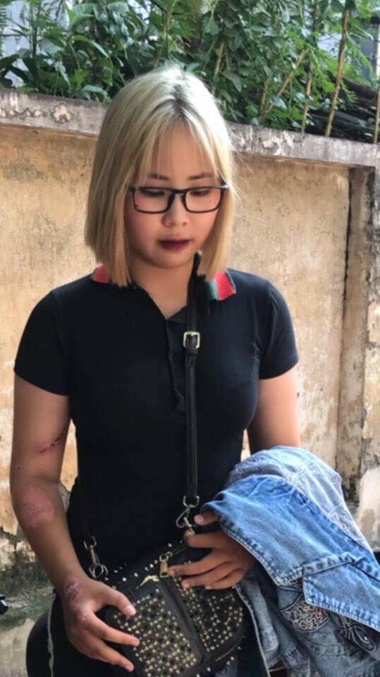 Thiếu nữ 15 tuổi lái xe máy tông gục 2 cảnh sát cơ động còn đăng Facebook nhờ bạn bè đến cứu