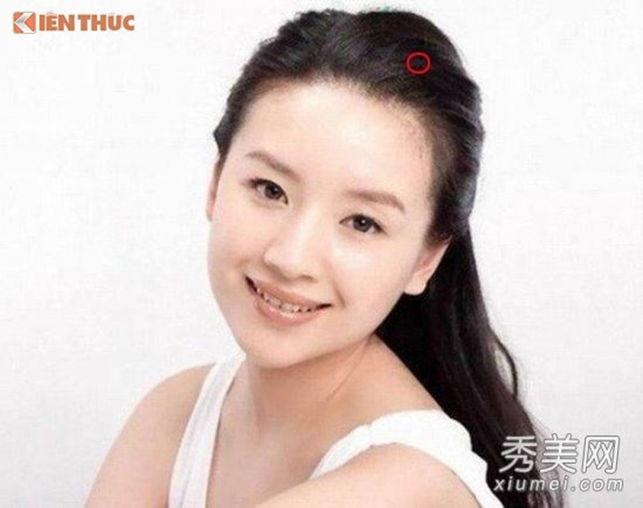 Nếu có nốt ruồi son ở những vị trí này, bạn là người luôn gặp may, có số hưởng sung sướng cả đời