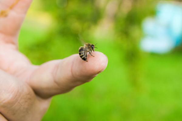 Bé gái tử vong vì ong đốt, bác sĩ viết nhật ký trực cảnh báo sai lầm của gia đình Bé gái tử vong vì ong đốt, bác sĩ viết nhật ký trực cảnh báo sai lầm của gia đình