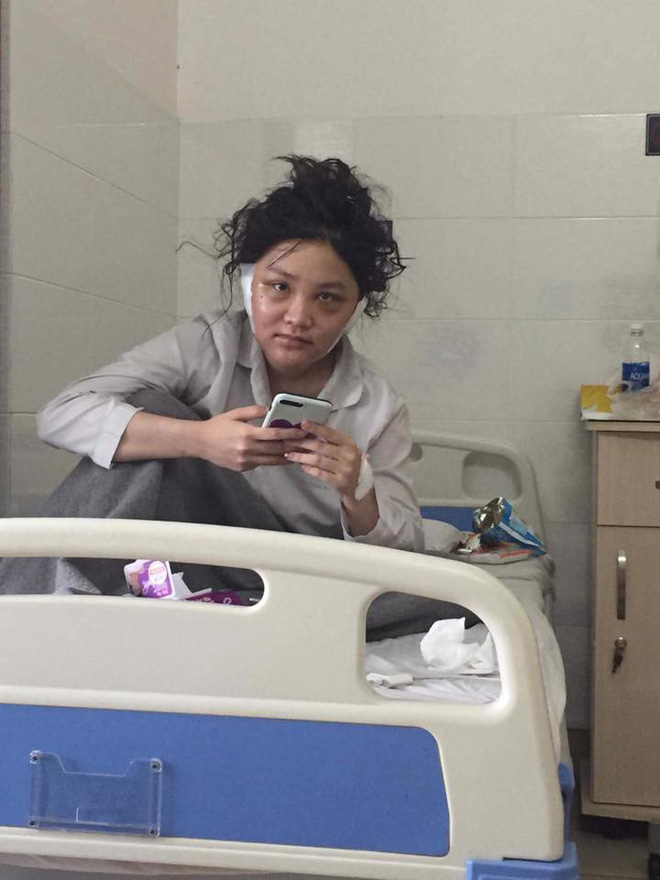 Lộ ảnh Kiều Anh Hera mặt sưng phù, da dẻ sần sùi khi vừa tỉnh dậy sau 6 tiếng PTTM