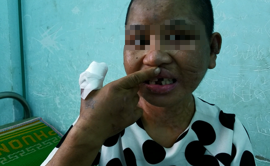 Vụ Nga vọc tra tấn dã man: Yêu cầu thêm 5 người liên quan đến làm việc