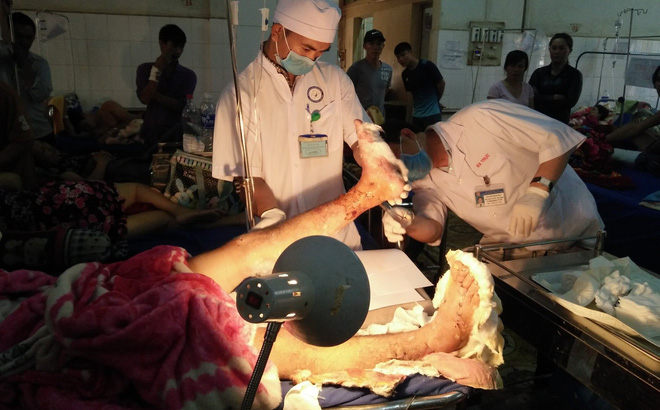 Nam thanh niên bị chém đứt lìa 2 cẳng chân