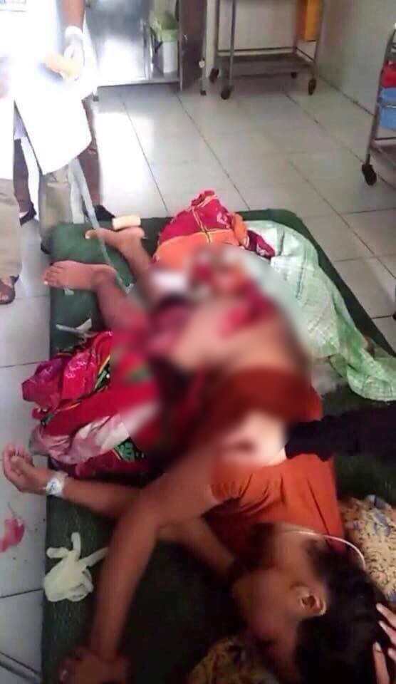 Thái Bình: Bé trai rơi xuống biển tử vong, mẹ nhảy xuống cứu bị cánh quạt máy tàu chém trọng thương