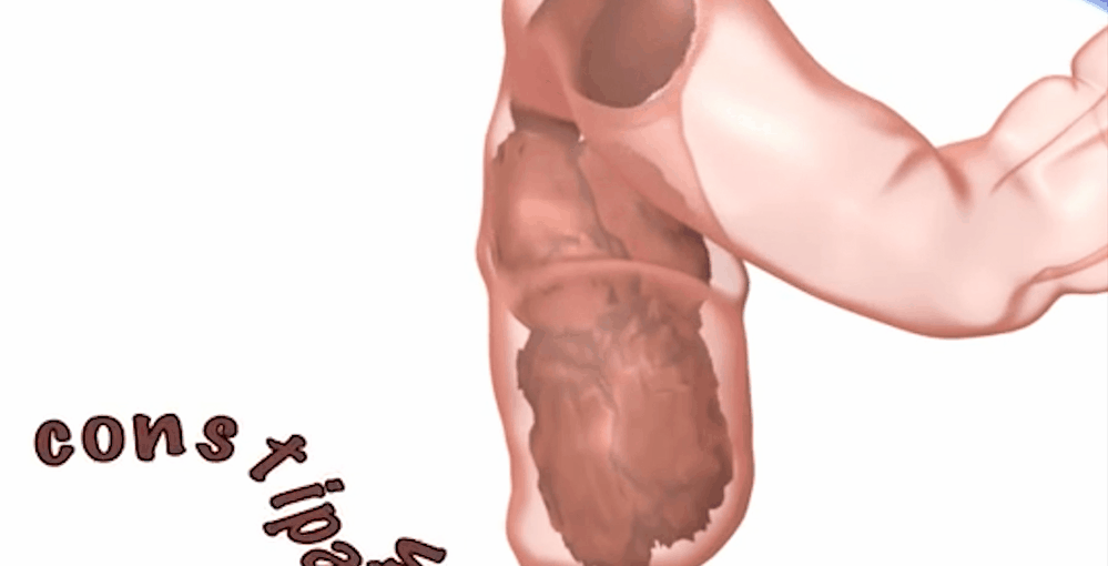 Hôi miệng chữa mãi không khỏi: Đây là 5 nguyên nhân và cách chữa chính xác bạn nên biết