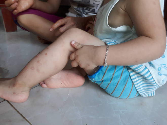 Về xã Kim Thượng nơi hàng chục người dương tính HIV: Chúng tôi không muốn quy kết trách nhiệm cho ai, chỉ mong người thân được chữa trị