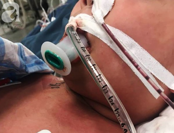 Hà Nội: Bé trai 7 tuổi đang khoẻ mạnh bỗng hôn mê vì suy đa tạng, nhiễm trùng máu sau trận sốt cao