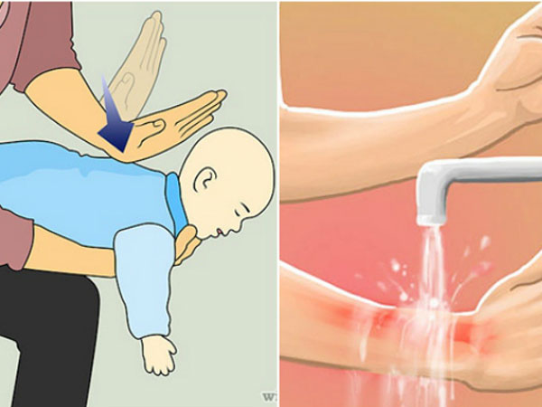 Sai lầm khi sơ cứu đa số người mắc phải