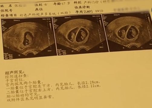 Thai phụ 67 tuổi bị bệnh viện từ chối thẳng thừng, biết được lý do bà đánh cược mạng sống để sinh con, ai cũng cảm động đến rơi lệ