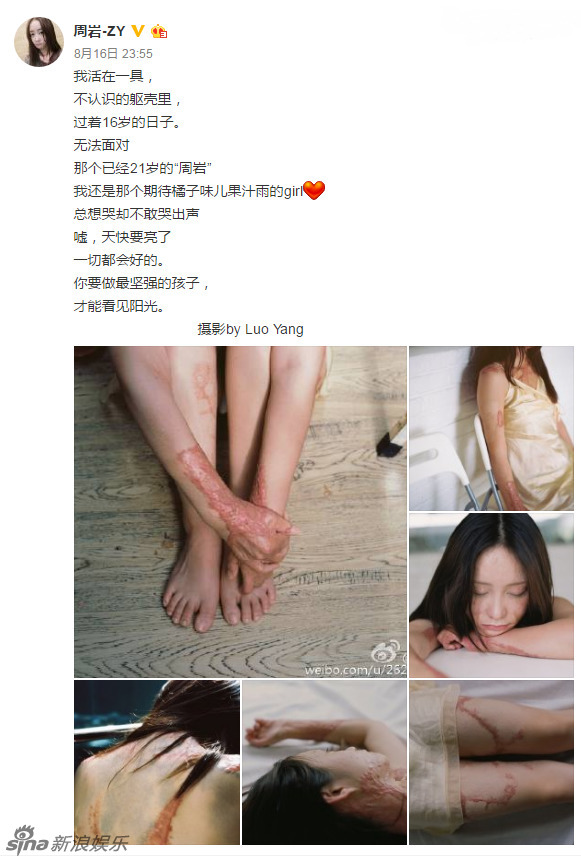 Cả gan từ chối tình cảm thiếu gia tài phiệt, cô gái bị thiêu sống tại chỗ và trải qua 7 năm đau đớn về thể xác lẫn tinh thần