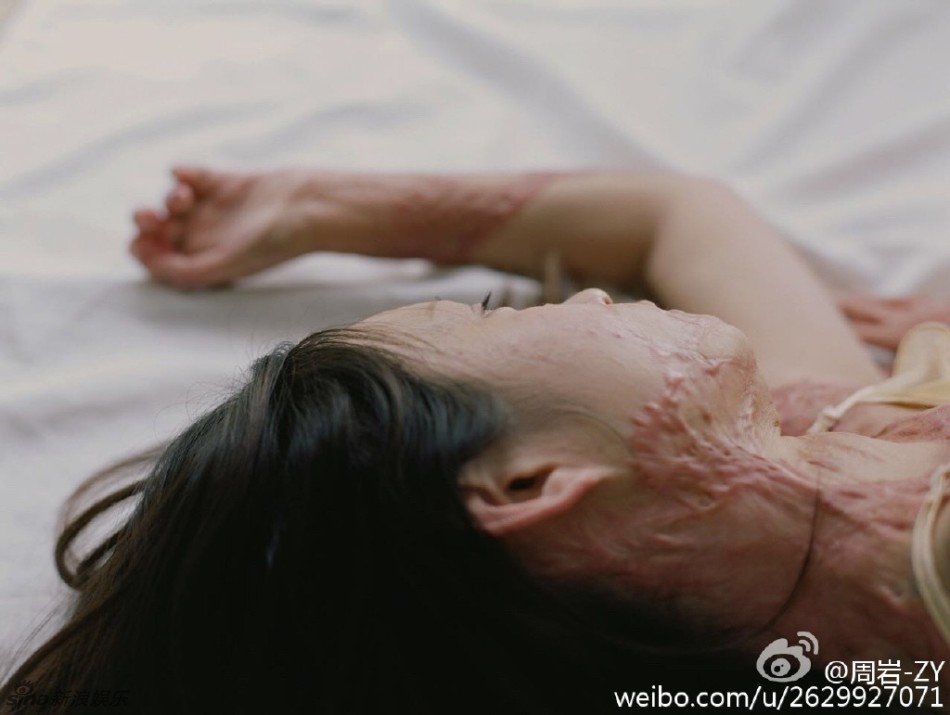 Cả gan từ chối tình cảm thiếu gia tài phiệt, cô gái bị thiêu sống tại chỗ và trải qua 7 năm đau đớn về thể xác lẫn tinh thần