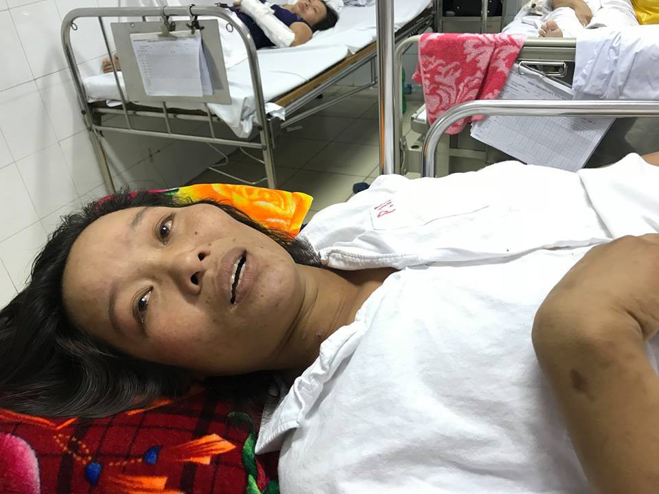 Mong ước giản dị của người mẹ bị cánh quạt máy chém trọng thương khi lao xuống biển cứu con trai