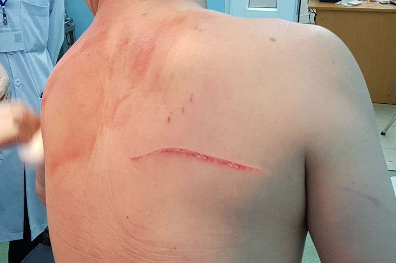 Bất ngờ kế hoạch đen phía sau vụ truy sát bác sĩ Chiêm Quốc Thái