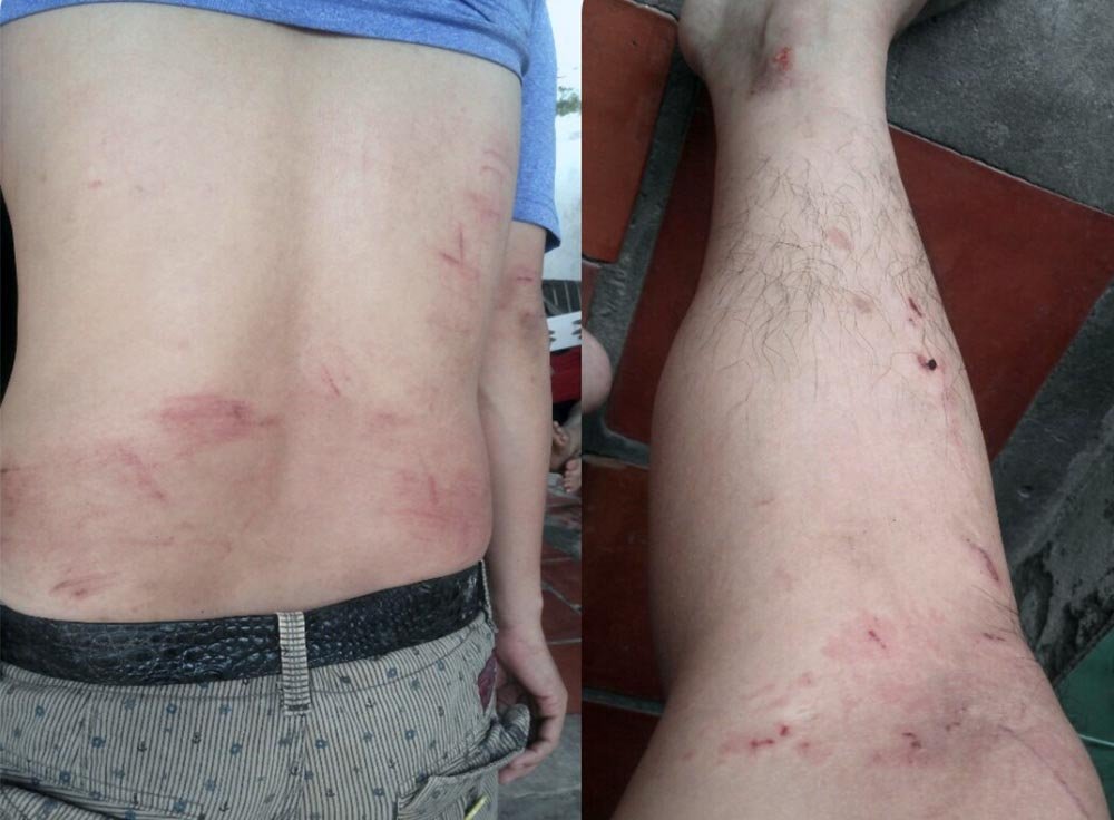 Vụ công văn đe dọa VTV9: Người trả lời trên truyền hình bị đánh