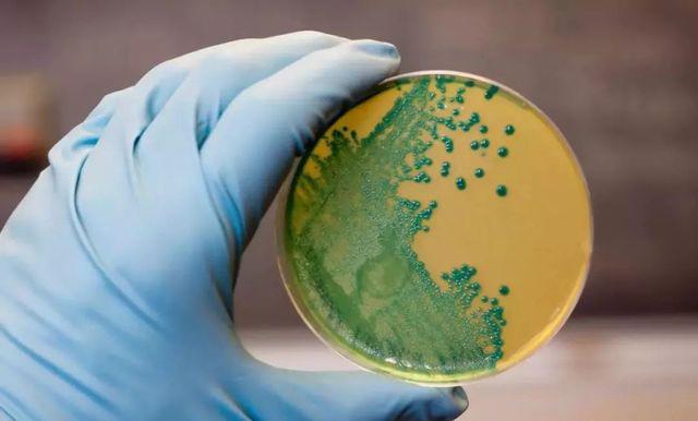 Từ vụ mẹ mất con do ăn hoa quả trong tủ lạnh, cẩn thận loại vi khuẩn không sợ lạnh