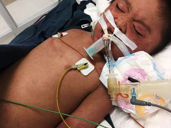 Phép màu đã không mỉm cười với cậu bé 7 tuổi bị nhiễm trùng máu, suy đa tạng ở Hà Nội