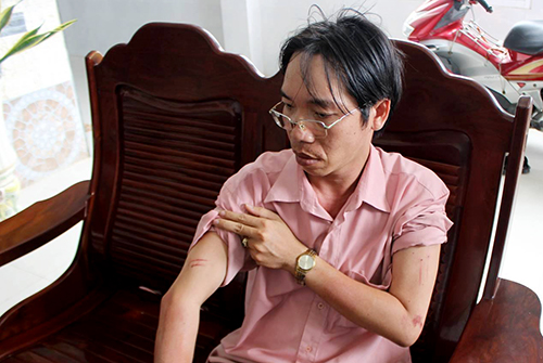 Chủ tiệm vàng trình báo bị chích điện, cướp hơn 3 tỷ đồng