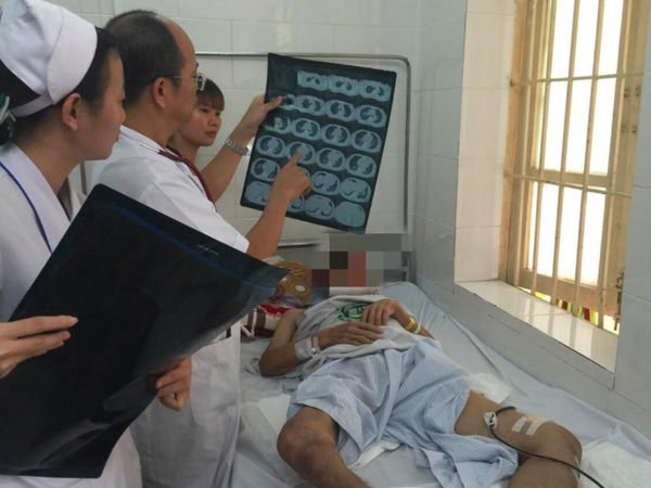 Loại vi khuẩn nguy hiểm khiến người bệnh có thể tử vong chỉ sau 48 giờ