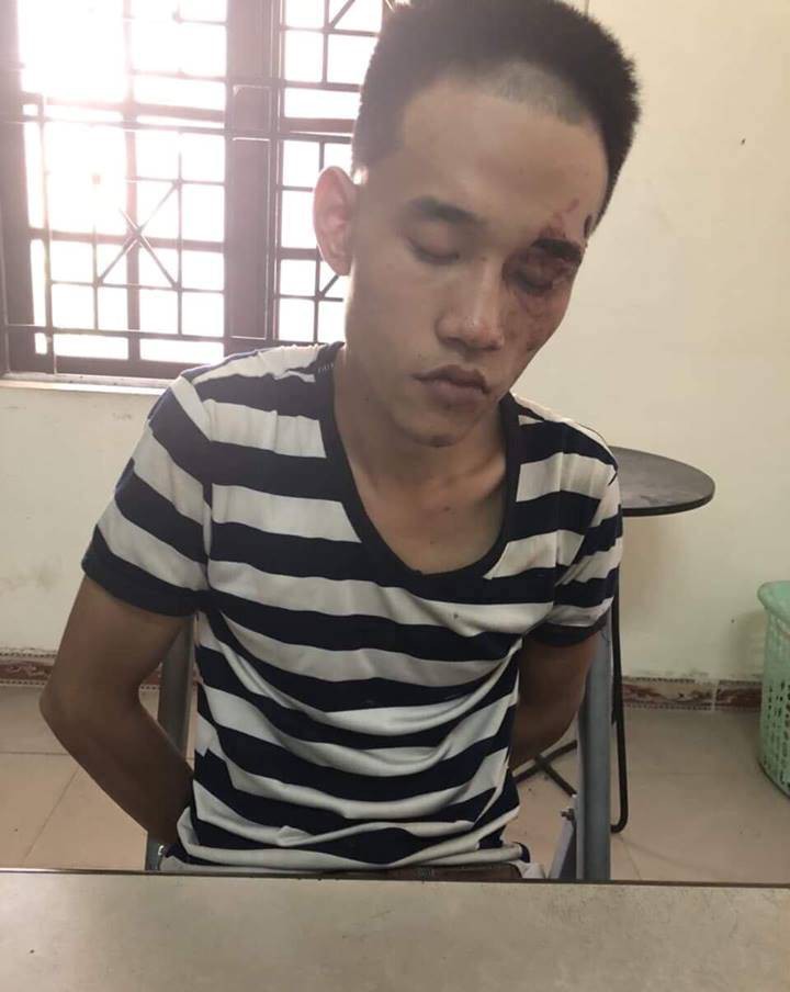 Chân dung nghi phạm 23 tuổi vô cớ cứa cổ người đàn ông đến dự đám tang bố ruột