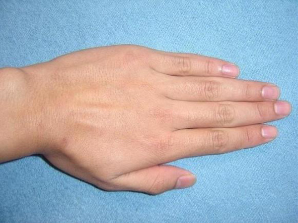 Nhìn kẽ hở bàn tay, biết ngay tương lai giàu sang hay túng thiếu