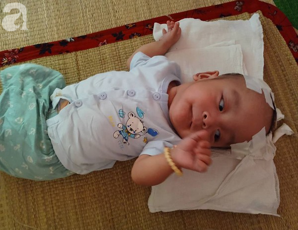 Sinh ra nặng chỉ 1kg, bé trai 14 tháng tuổi đau đớn chống chọi với căn bệnh quái ác