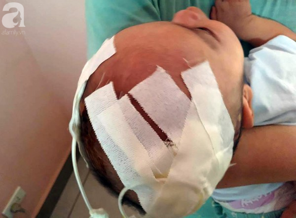Sinh ra nặng chỉ 1kg, bé trai 14 tháng tuổi đau đớn chống chọi với căn bệnh quái ác