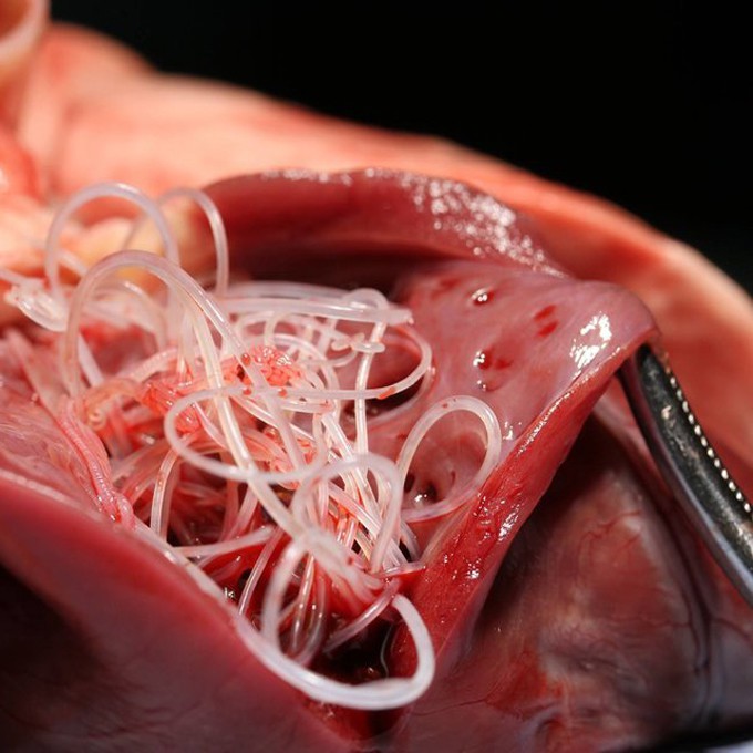 Bác sĩ phát hoảng khi lôi con ký sinh trùng dài 9cm từ não của cô gái 16 tuổi: Cảnh báo cẩn trọng từ món ăn nhiều người thích