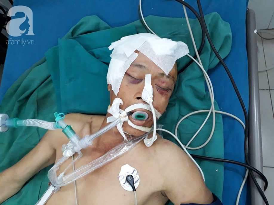 TP.HCM: Người đàn ông chấn thương sọ não vì tai nạn vẫn chưa có người thân vào nhận sau 2 ngày nằm viện