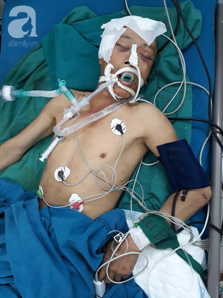 TP.HCM: Người đàn ông chấn thương sọ não vì tai nạn vẫn chưa có người thân vào nhận sau 2 ngày nằm viện