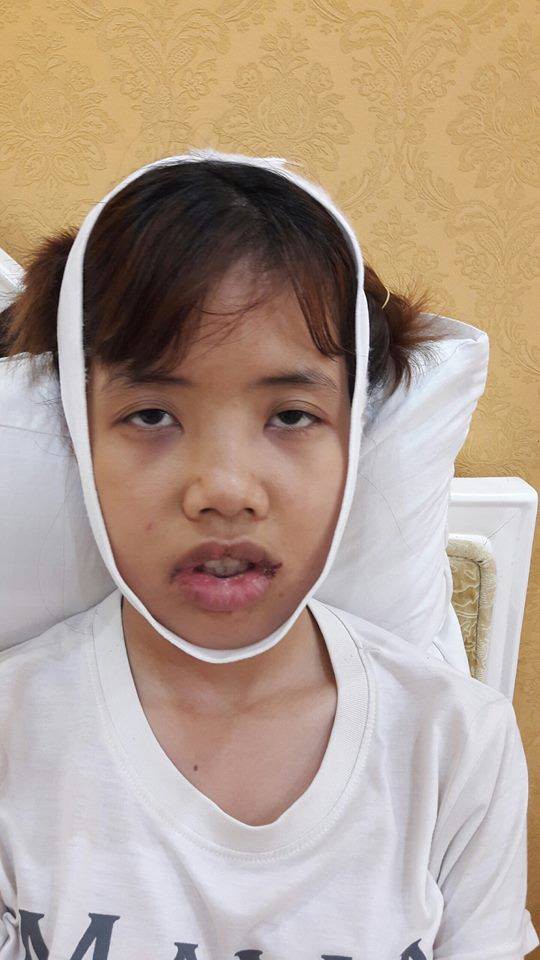 Đập đi xây lại 3 lần trong 6 tháng: Hành trình lột xác của cô gái từng bị đuổi việc vì quá xấu gây sốt MXH