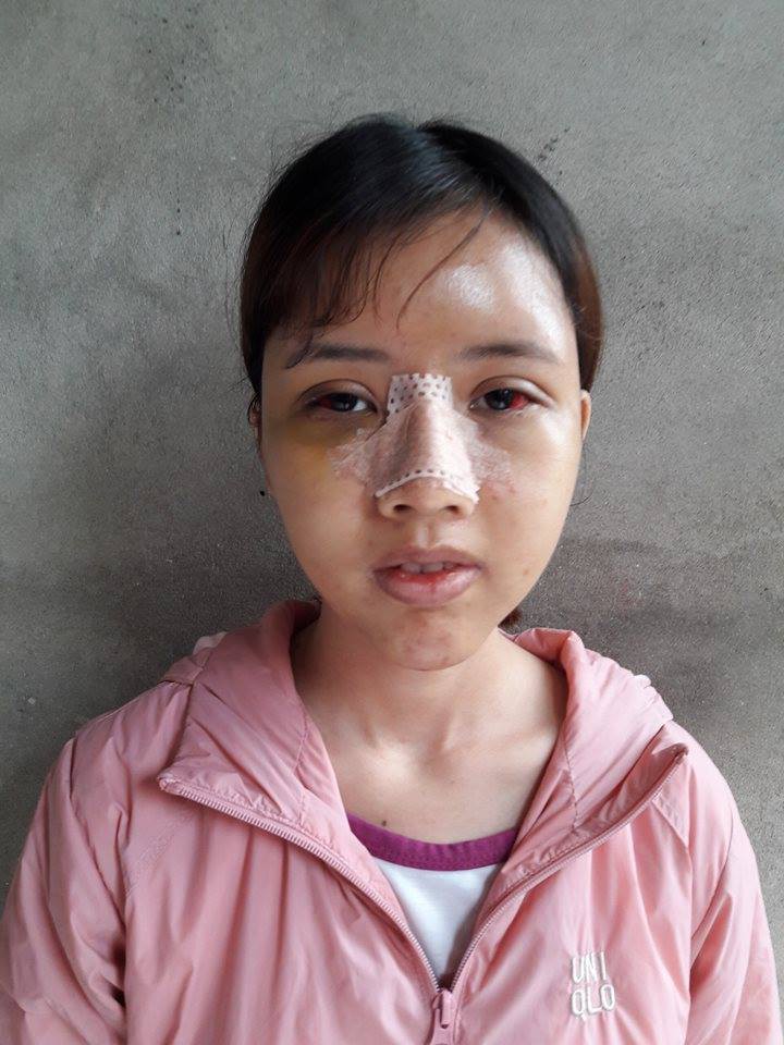 Đập đi xây lại 3 lần trong 6 tháng: Hành trình lột xác của cô gái từng bị đuổi việc vì quá xấu gây sốt MXH