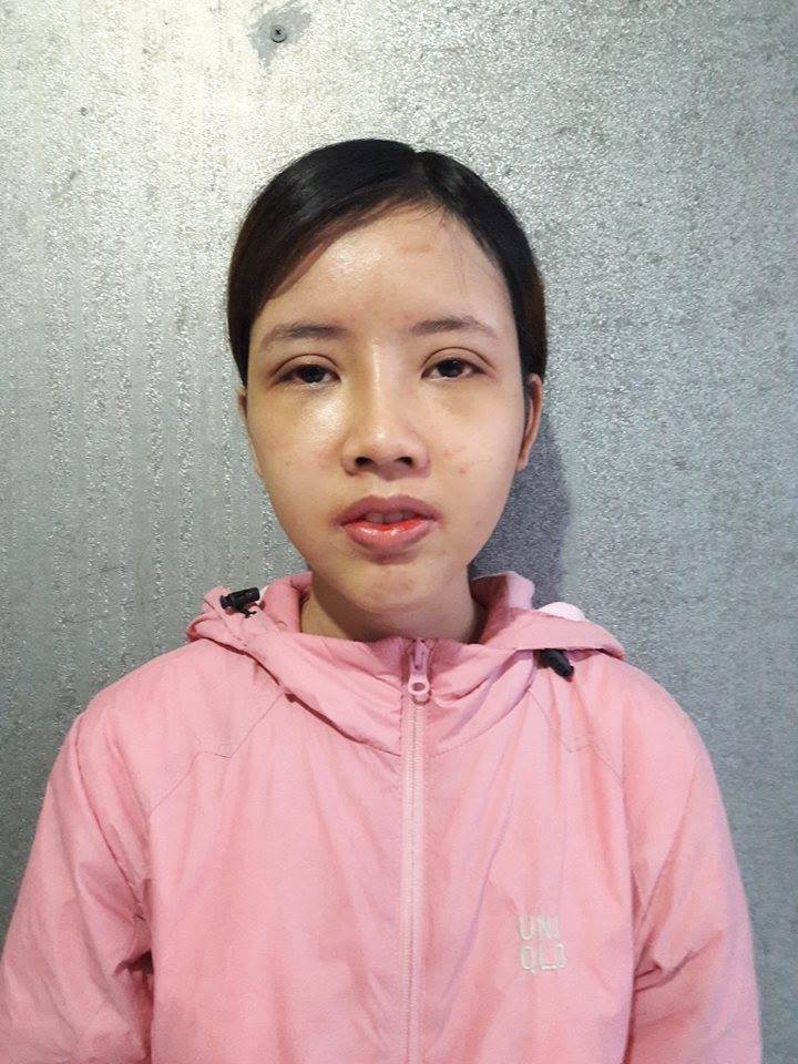 Đập đi xây lại 3 lần trong 6 tháng: Hành trình lột xác của cô gái từng bị đuổi việc vì quá xấu gây sốt MXH