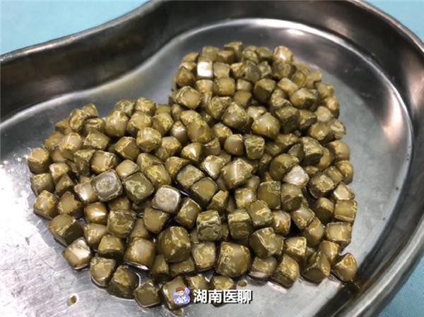 Nếu là nữ giới thì cần đặc biệt ghi nhớ những điều sau để không gặp phải sự cố kinh hoàng như người phụ nữ này