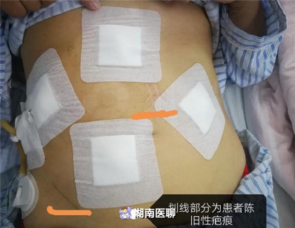 Nếu là nữ giới thì cần đặc biệt ghi nhớ những điều sau để không gặp phải sự cố kinh hoàng như người phụ nữ này