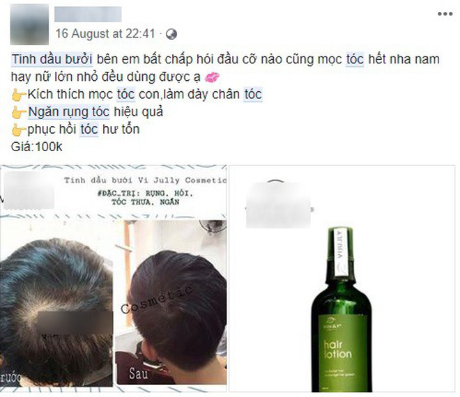 Cư dân mạng kháo nhau dùng tinh dầu bưởi tóc từ mỏng thành dày, nhưng liệu nó có thực sự thần thánh đến vậy? Cư dân mạng kháo nhau dùng tinh dầu bưởi tóc từ mỏng thành dày, nhưng liệu nó có thực sự thần thánh đến vậy?