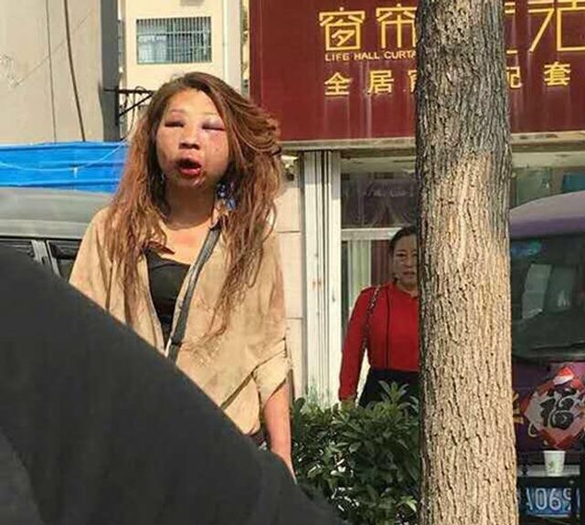 Cặp kè với người đã có vợ, hotgirl bị đánh ghen tới biến dạng mặt mũi