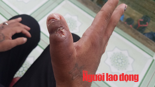 Vụ Nga vọc tra tấn dã man: Y Nhiêu khai gì với công an?