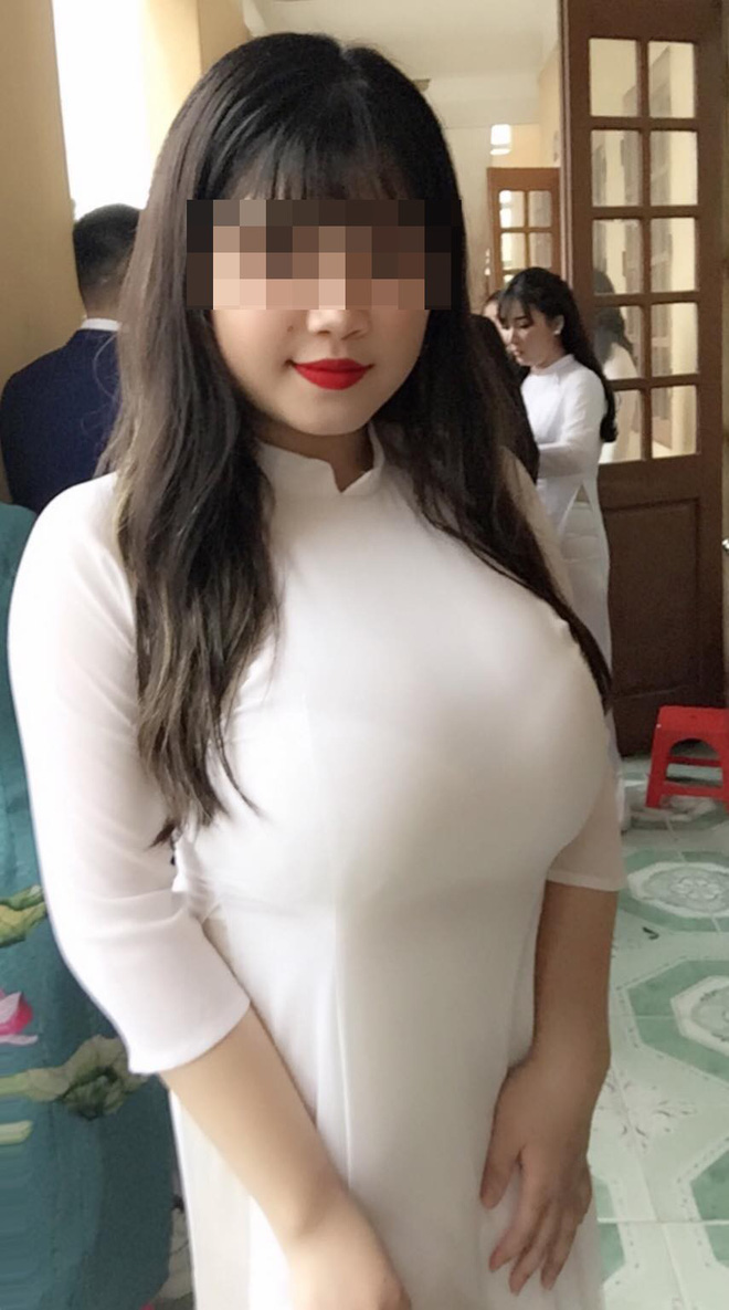 Hotgirl Hải Dương có vòng một lên tới 110cm, bác sĩ kết luận lý do bất ngờ