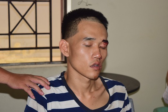 Bắt đối tượng dùng dao giết chết người đến viếng đám tang cha mình