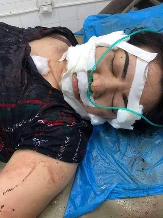 Người chồng rạch mặt, cắt gân vợ lý giải vì... quá yêu: Tôi gây ra chuyện vì biết cô ấy về làm thủ tục kết hôn với người nước ngoài