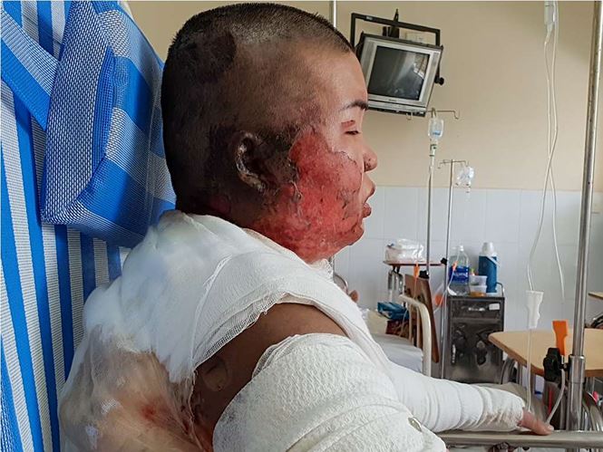 Chị uất nghẹn khi hai cháu bị người tình của em gái tẩm xăng đốt chết