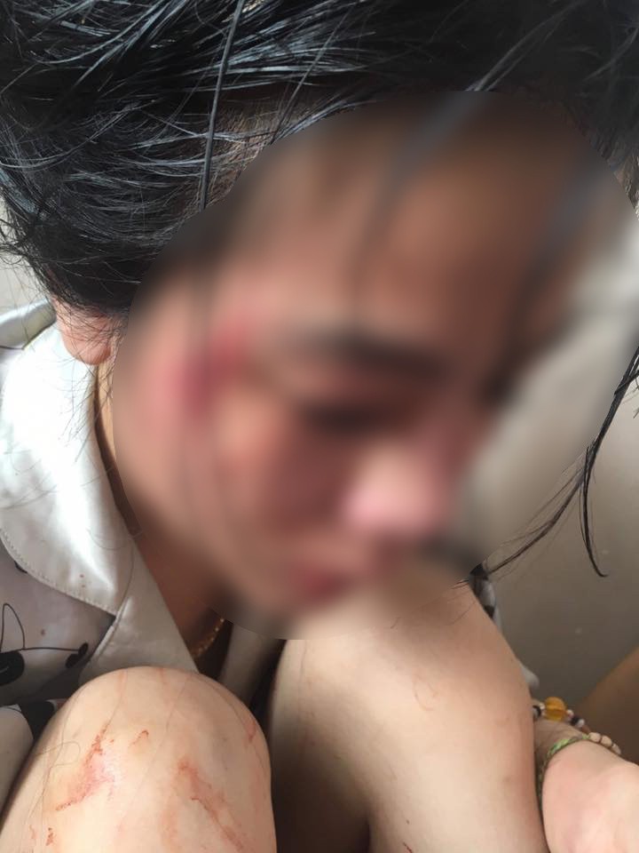 Cô gái trong clip bị cắt tóc, đánh ghen gây xôn xao MXH lên tiếng: Mong cơ quan chức năng giúp tôi lấy lại danh dự