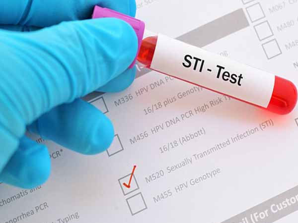 Đừng chủ quan với căn bệnh tình dục này, nó sẽ khiến bạn ân hận cả đời nếu không biết