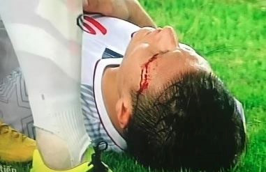 Bạn gái Quang Hải: Nhìn anh ngã bị chảy máu, em chỉ thấy xót