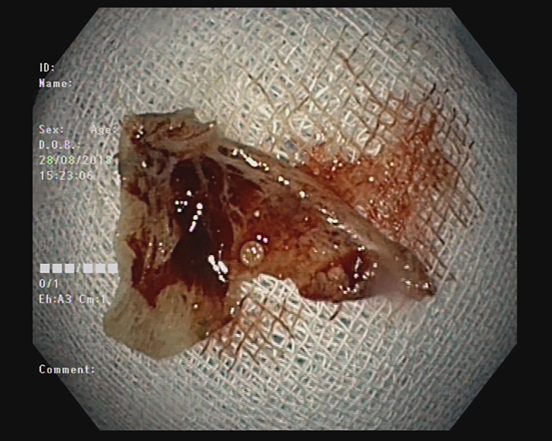 Hóc xương cá đúng lúc quả bóng vàng của U23 Việt Nam sút tung lưới U23 Syria
