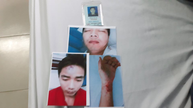 Công nhân tố bị công an xã đánh đập, còng tay vì... 11 đôi giầy