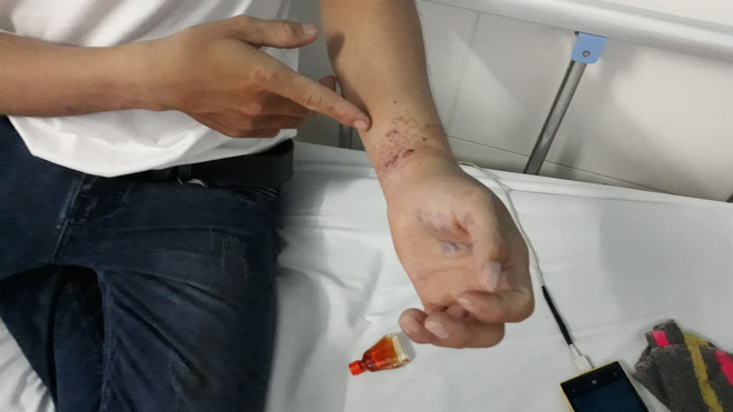 Công nhân tố bị công an xã đánh đập, còng tay vì... 11 đôi giầy