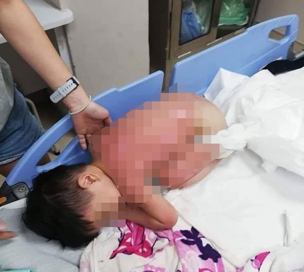 Cùng mẹ chơi dưới bếp, bé trai 2 tuổi bị bỏng nặng khi mặt bếp bất ngờ phát nổ, lời cảnh báo đáng sợ dành cho các phụ huynh Cùng mẹ chơi dưới bếp, bé trai 2 tuổi bị bỏng nặng khi mặt bếp bất ngờ phát nổ, lời cảnh báo đáng sợ dành cho các phụ huynh